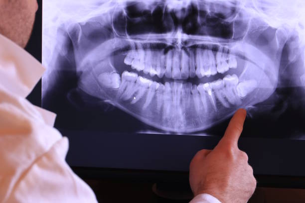 Best Emergency Broken Tooth Repair in East Los Angeles, CA